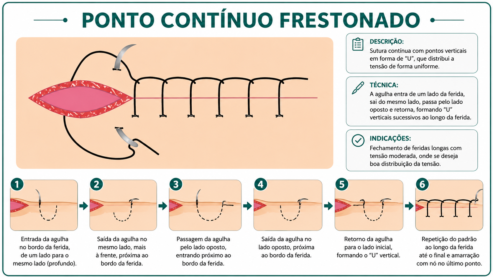 Ilustração da técnica Ponto Contínuo Festonado (Ancorado)