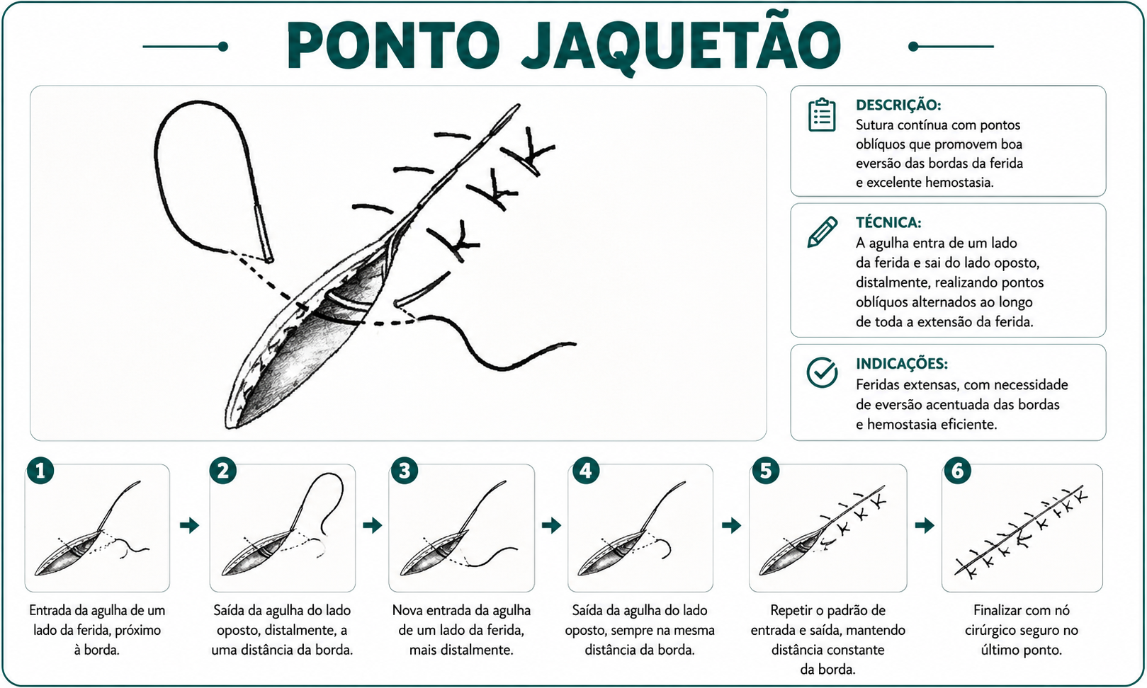 Ilustração da técnica Ponto Jaquetão